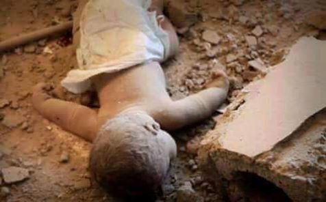 طفل من ضحايا العدوان السعودي