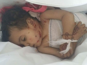 اطفال اليمن ضحايا الغارات